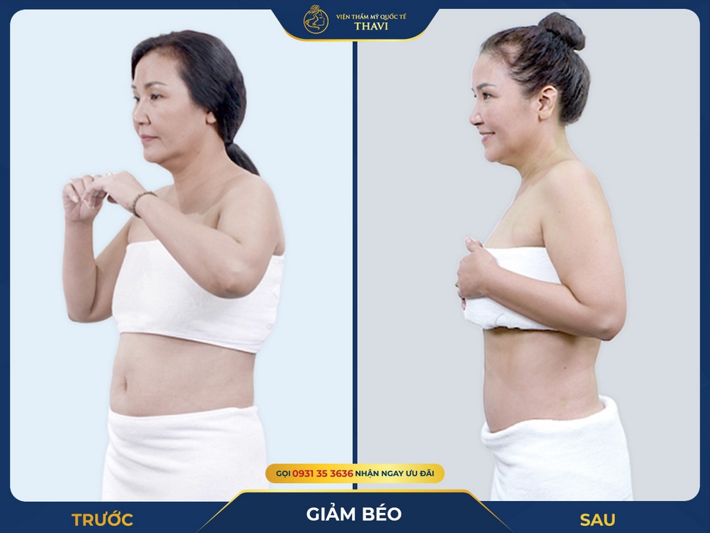 Giảm béo