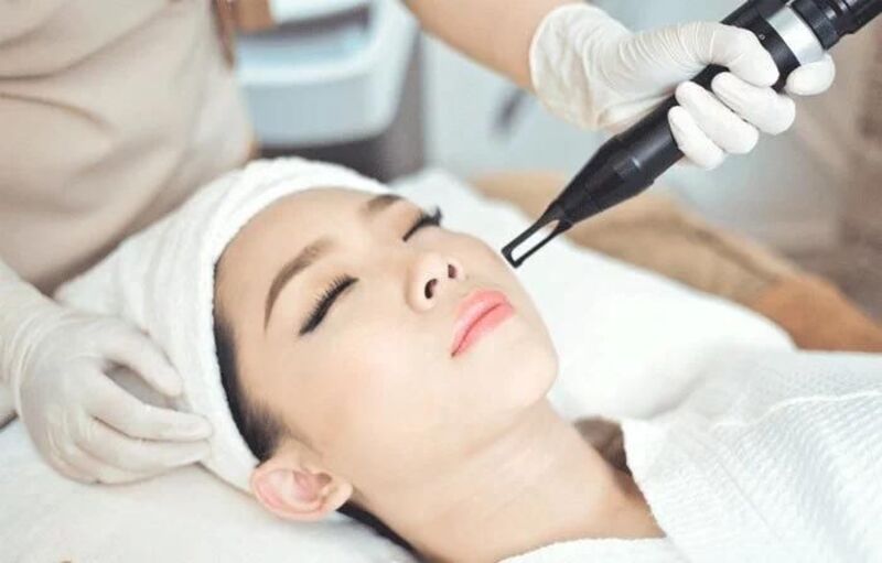 Điều trị nám bằng laser là phương pháp đang rất được tin dùng (Nguồn: Internet)