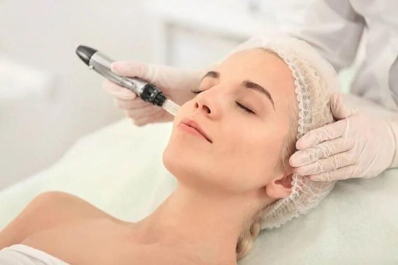 Điều trị nám bằng laser với địa chỉ uy tín, trang thiết bị hiện đại (Nguồn: Internet)