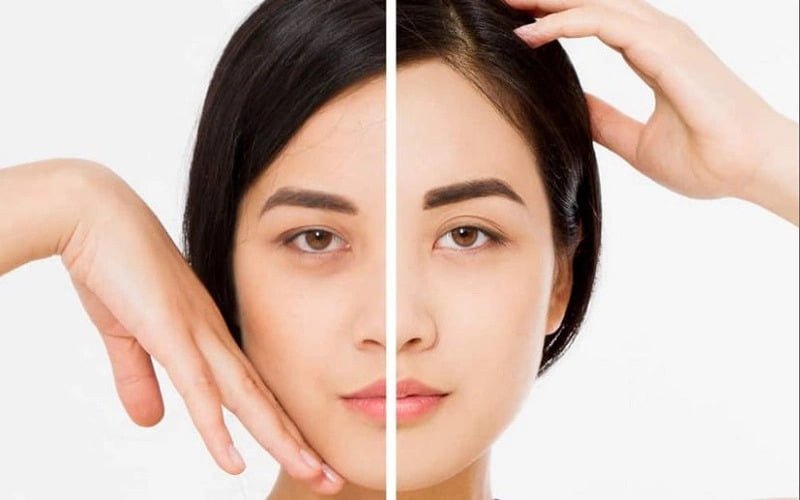 Nâng cung chân mày không chỉ là một xu hướng thẩm mỹ được ưa chuộng mà còn mang lại nhiều lợi ích tuyệt vời cho khuôn mặt bạn (Nguồn: Internet)