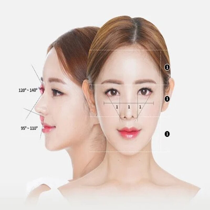 Phương pháp nâng mũi cấu trúc là như thế nào? (Nguồn: Internet)