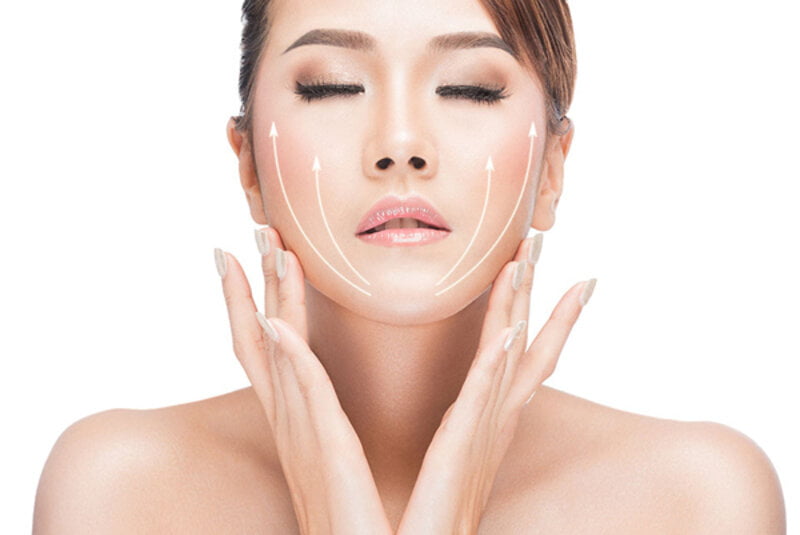 Căng da mặt bằng chỉ (Nguồn: Internet)