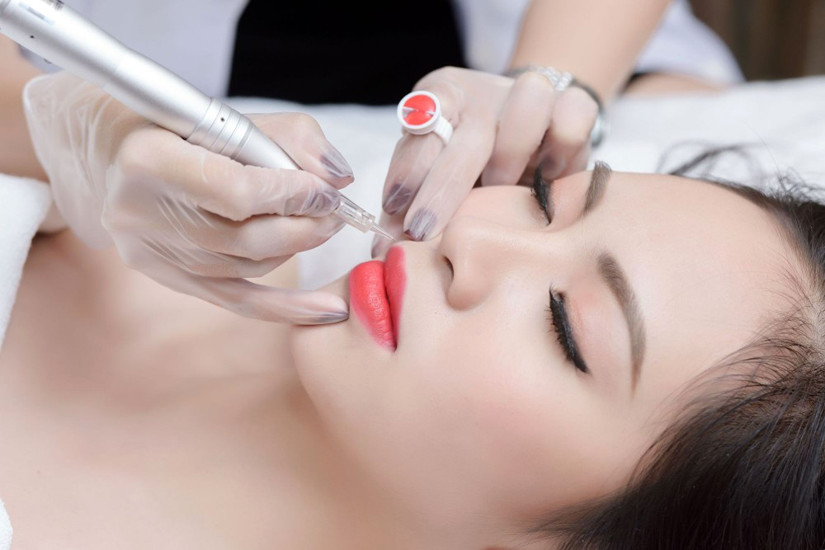 Phun môi collagen màu đỏ tươi (Nguồn:Internet)