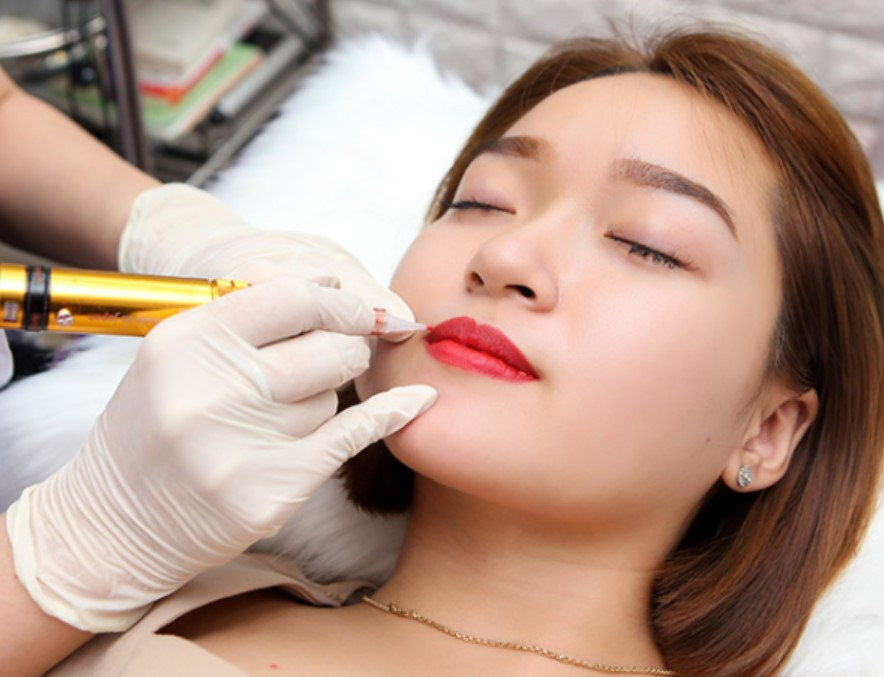 Phun môi collagen đẹp tại THAVI (Nguồn: Internet)