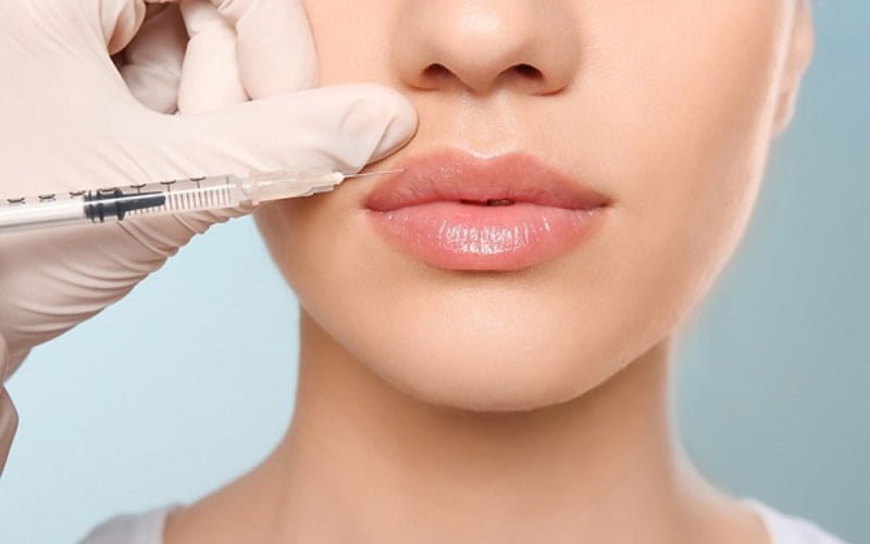 Tiêm filler môi mũi cằm đang dần trở thành "cơn sốt" trong lĩnh vực thẩm mỹ (Nguồn: Internet)