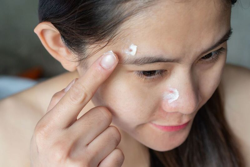 Thuốc trị mụn viêm không kê đơn thường được dùng ở dạng bôi ngoài (Nguồn: Internet)